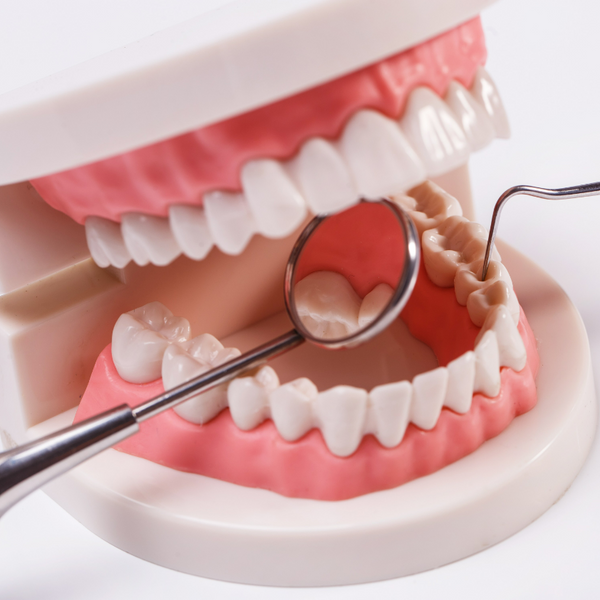 7 FAQs About Pit and Fissure Sealing
